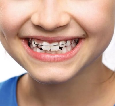 Dental Examination